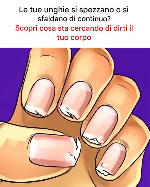 Le tue unghie si screpolano o si spezzano costantemente? Questo è il messaggio che il tuo corpo sta cercando di inviarti
