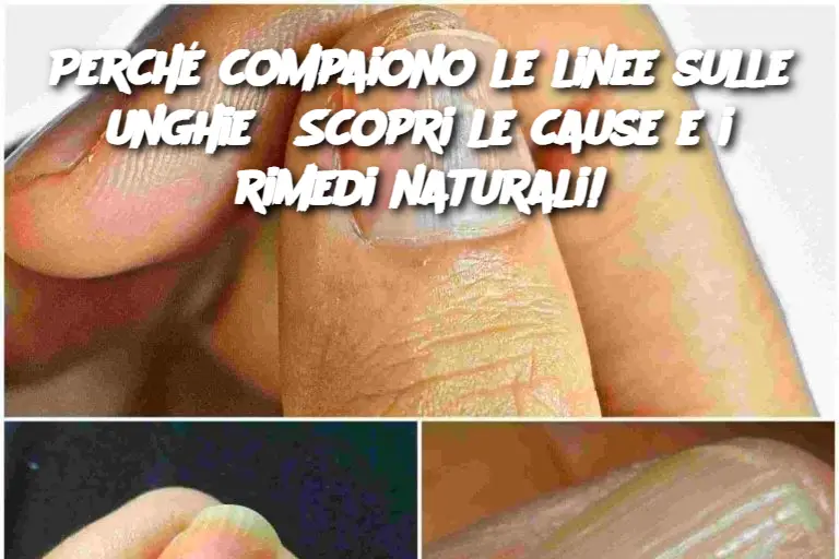 Perché compaiono le linee sulle unghie? Scopri le cause e i rimedi naturali!