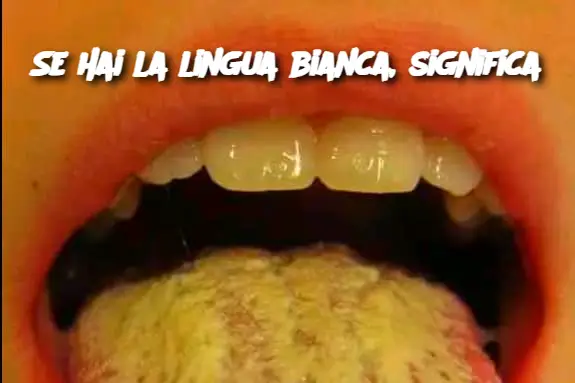 Se hai la lingua bianca, significa