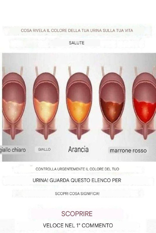 Il colore della tua urina può rivelare tutto sulla tua salute! (Controllate urgentemente questa lista!)