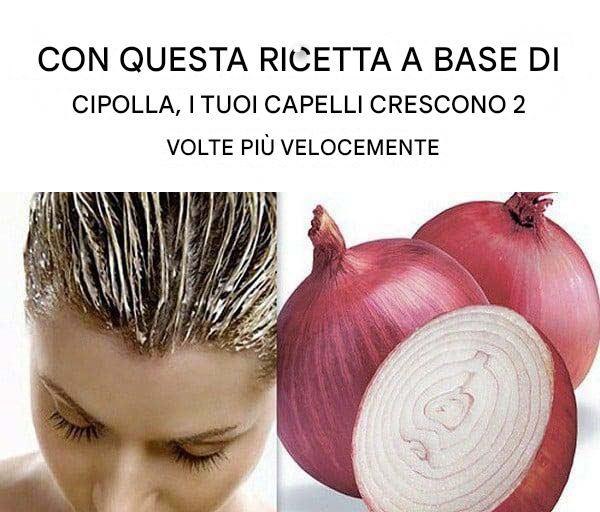 Caduta dei capelli: scopri questo consiglio per stimolare la crescita dei capelli.