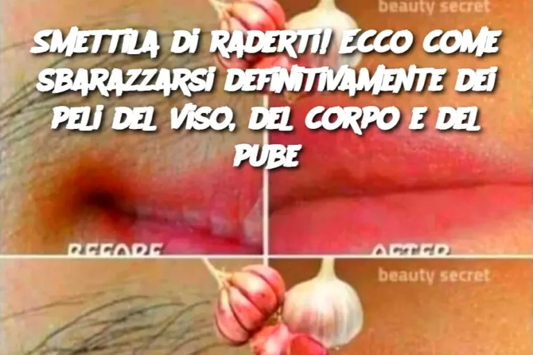 Smettila di raderti! Ecco come sbarazzarsi definitivamente dei peli del viso, del corpo e del pube