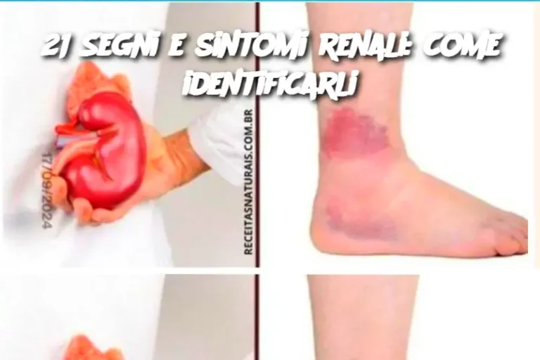 21 Segni e sintomi renali: come identificarli