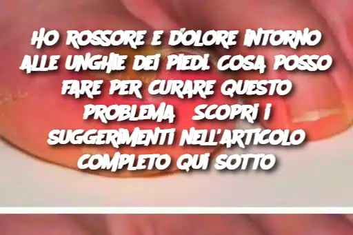 Ho rossore e dolore intorno alle unghie dei piedi. Cosa posso fare per curare questo problema? Scopri i suggerimenti nell'articolo completo qui sotto