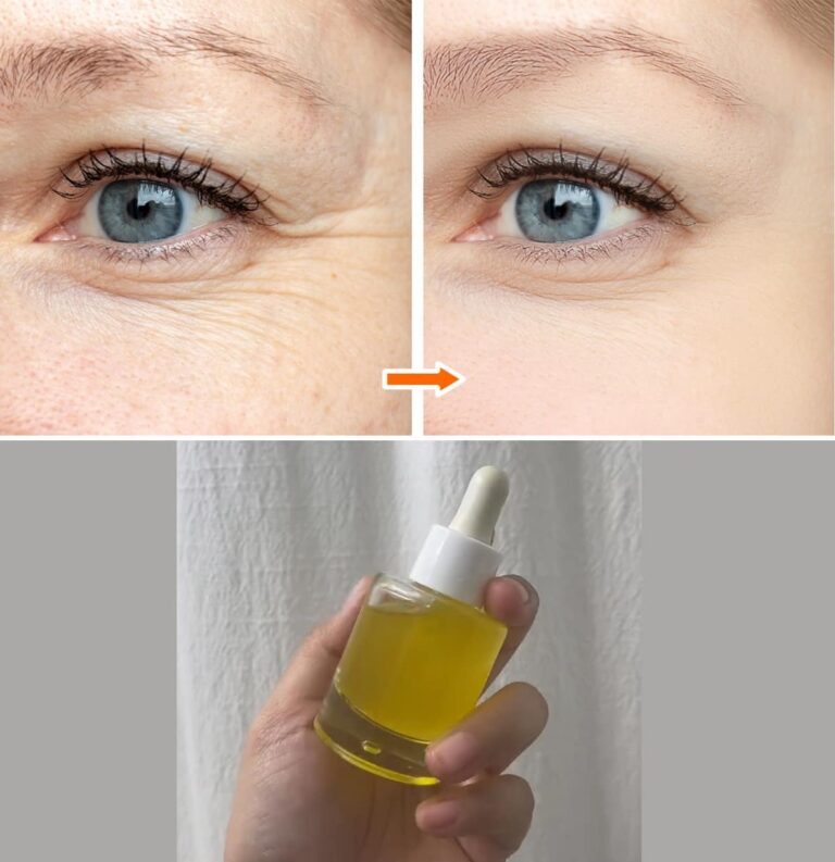 Come preparare il retinolo naturale che elimina le rughe e ringiovanisce il viso di 15 anni