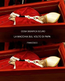 Cos'è quella macchia scura sul volto di Papa Francesco: le ipotesi degli esperti