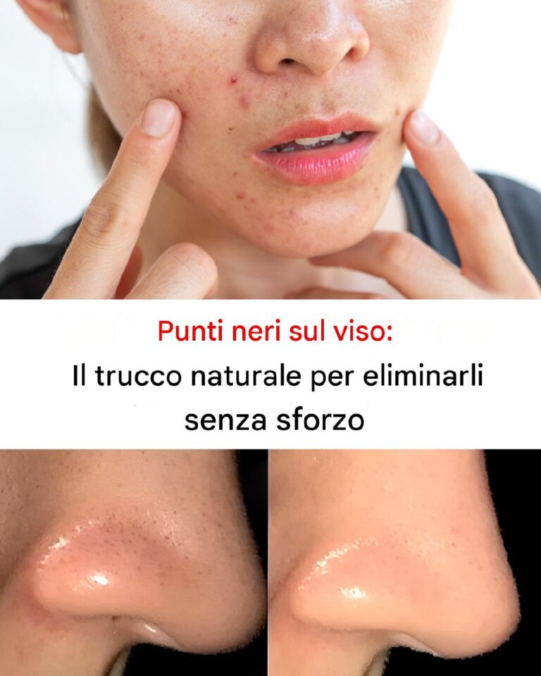 Maschera Naturale Anti-Punti Neri: Soluzione Fai-da-Te per una Pelle Pulita e Luminosa