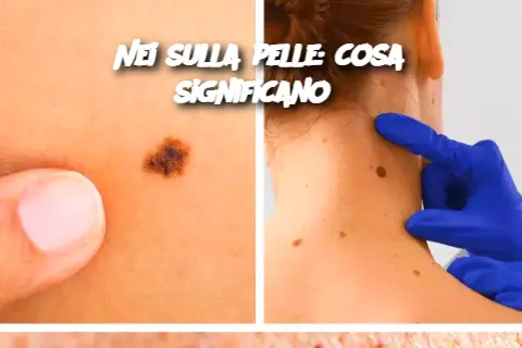 Nei sulla pelle: cosa significano?
