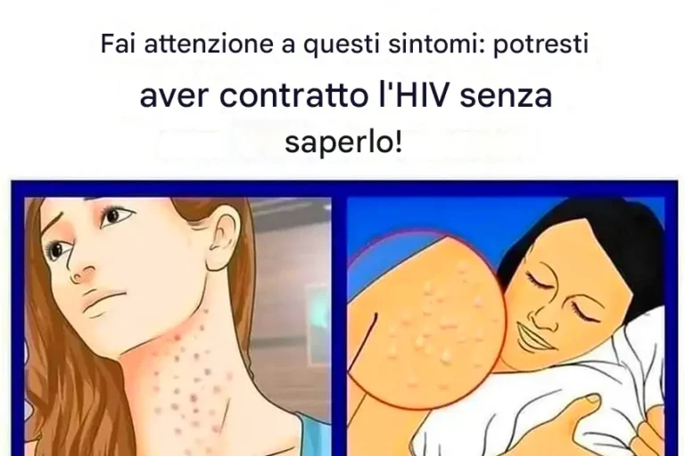 HIV: i primi sintomi da non ignorare.