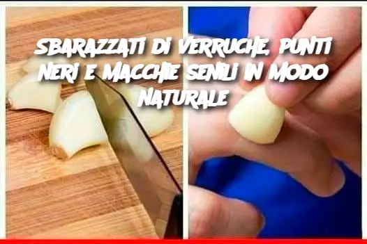 Sbarazzati di verruche, punti neri e macchie senili in modo naturale