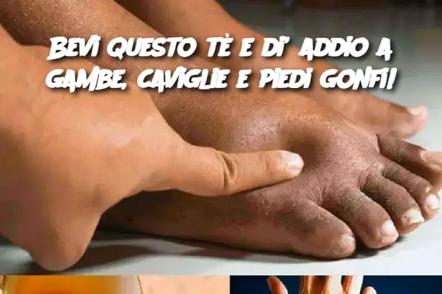 Bevi questo tè e di’ addio a gambe, caviglie e piedi gonfi!