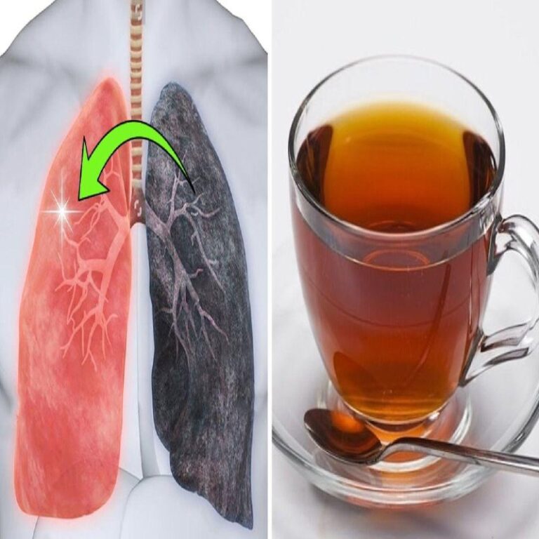 Come purificare i polmoni ed eliminare i residui di nicotina, muco e tossine – Link nel primo commento