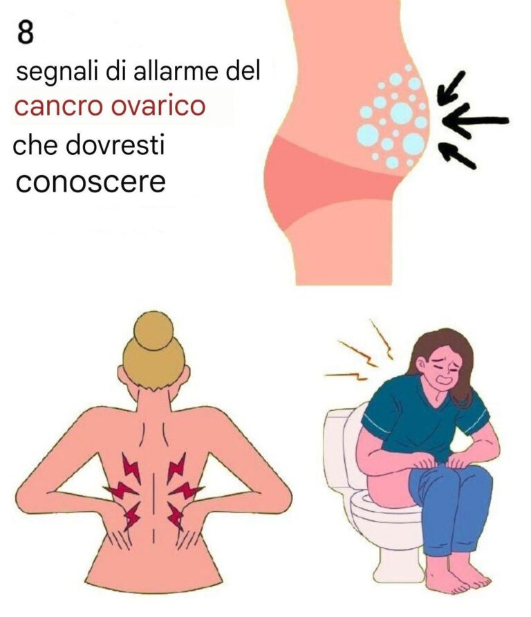 8 segnali di allarme del cancro ovarico che non dovresti ignorare