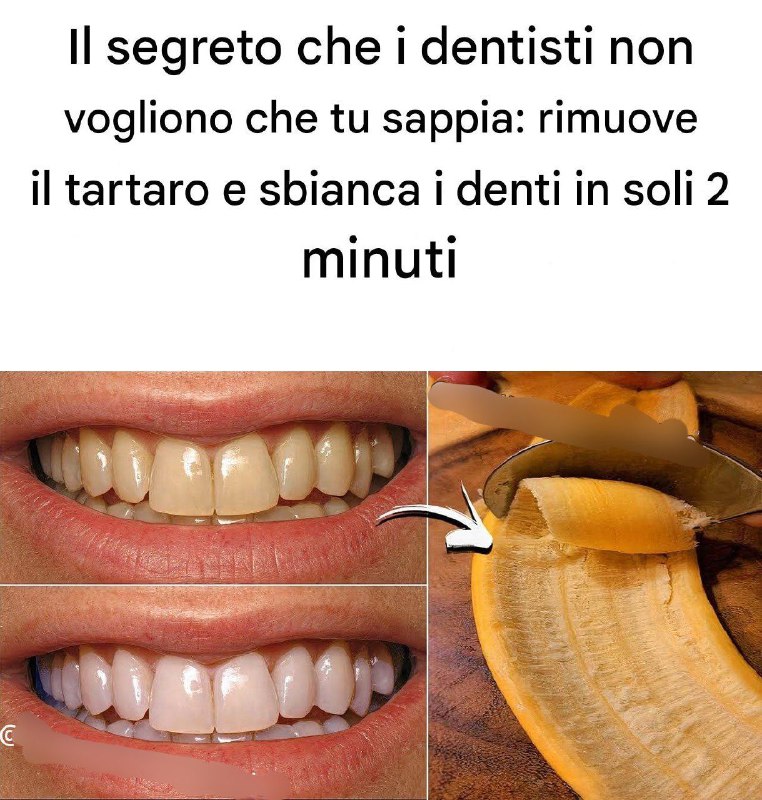Il segreto che i dentisti non vogliono che tu sappia:
