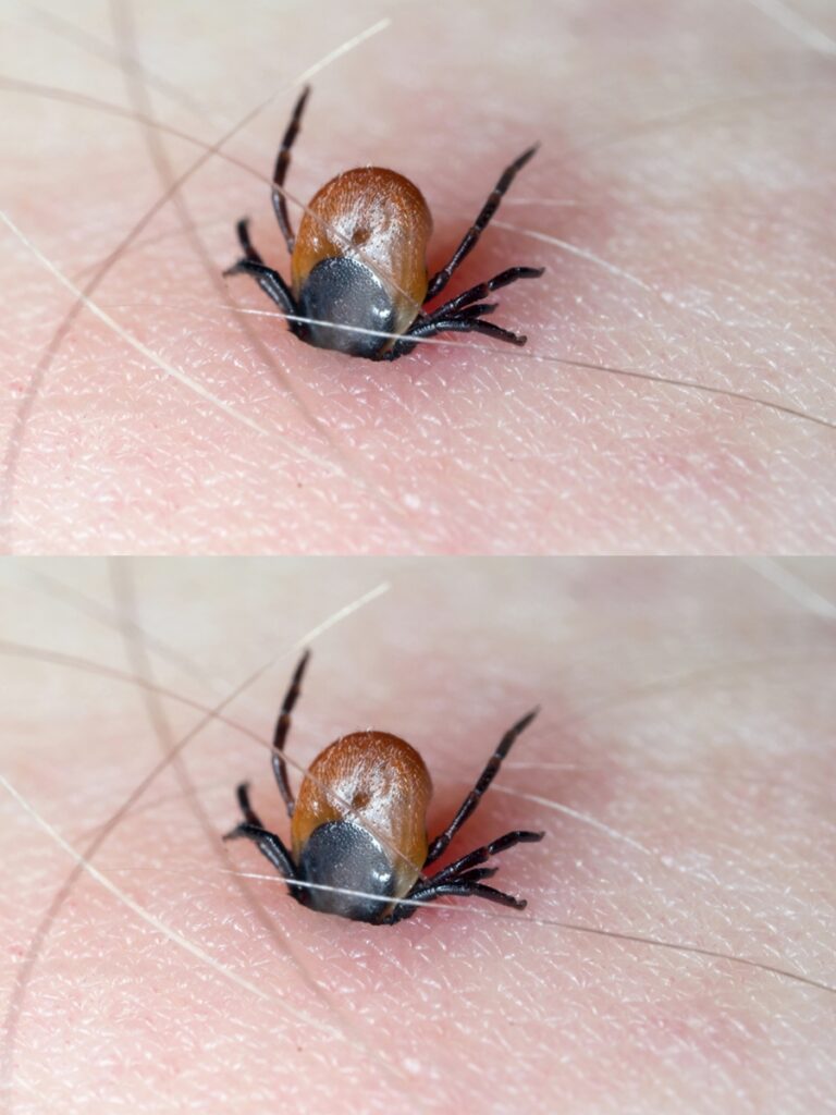 Tutti hanno questa pianta in cucina, ma pochi sanno a cosa serve: basta farla bollire, spruzzarla sulla pelle e le zecche scapperanno!