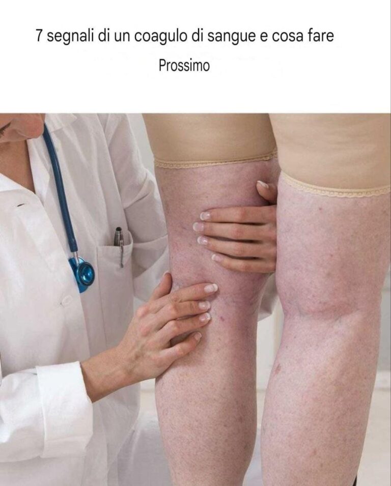 Davvero utile! Li terrò d'occhio