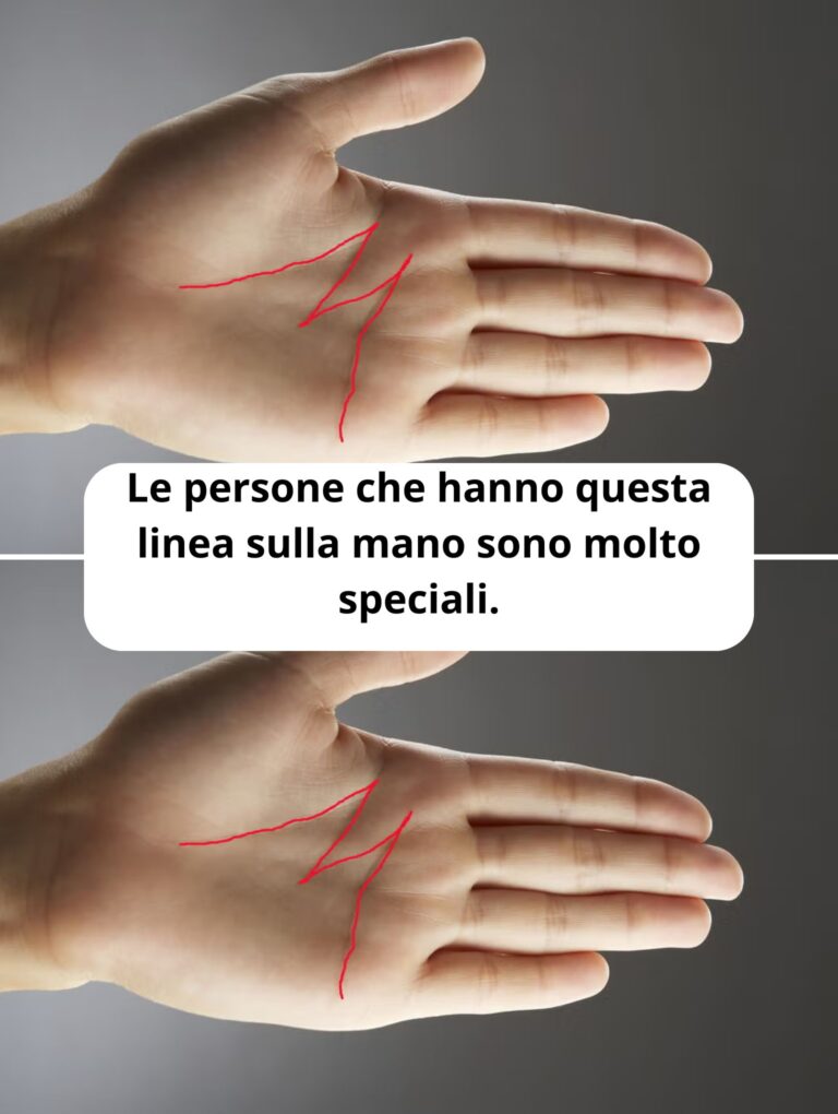 Le persone che hanno questa linea sulla mano sono molto speciali.