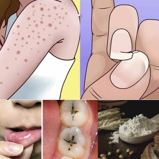 9 segnali di intolleranza al glutine che tutti dovrebbero conoscere