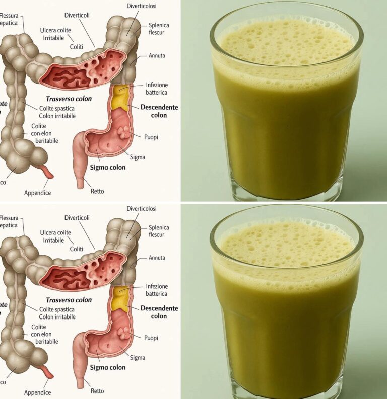 "Succo Detox Intestinale: La Ricetta Naturale che Libera il Corpo dalle Tossine"