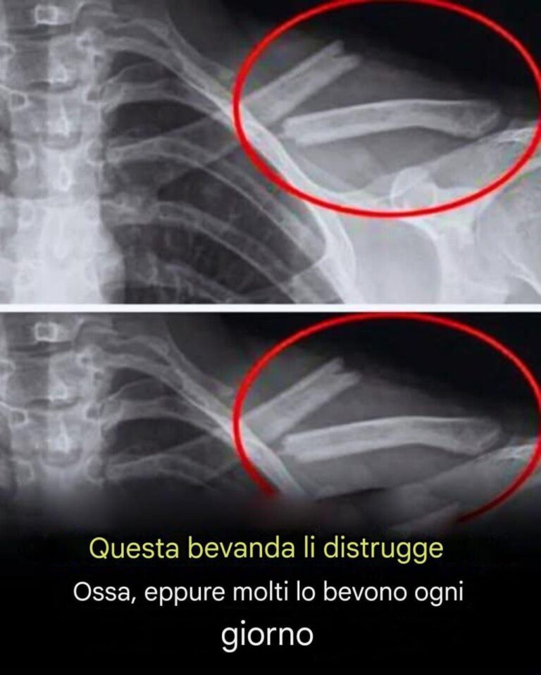 Questa bevanda distrugge le ossa, eppure molte persone la bevono quotidianamente