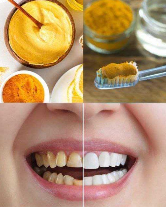 "Sorridi con la Curcuma: Il Segreto Naturale per Denti Più Bianchi e Gengive Sane"
