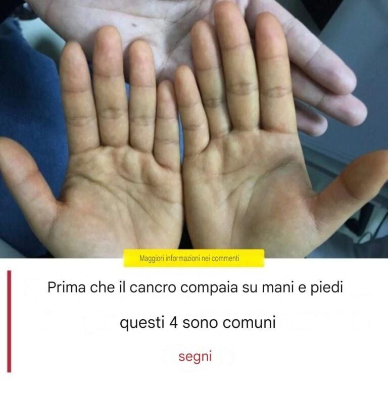 Prima che il cancro si manifesti, mani e piedi mostrano spesso questi 4 segnali