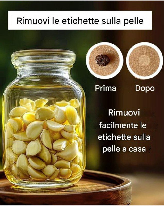 Rimouvi le etichette sulls pelle