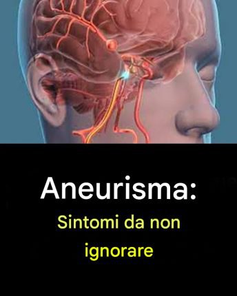 Aneurisma: segnali da non ignorare...