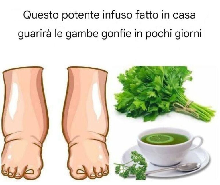Questo forte infuso fatto in casa curerà le gambe gonfie in pochi giorni