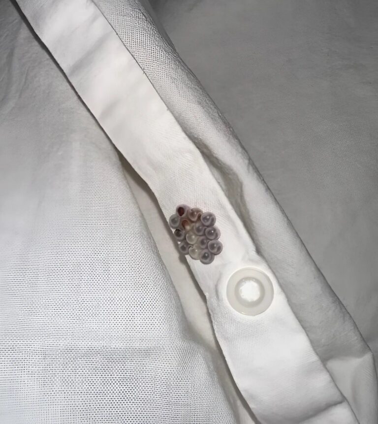 Stamattina ho scoperto delle piccole palline rotonde nel mio letto ...