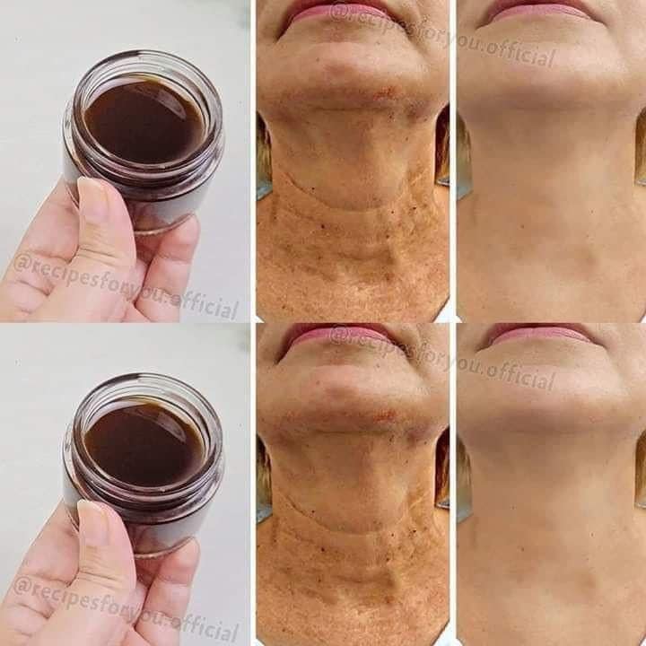 Olio per un aspetto più giovane: l'olio di caffè riduce le rughe in modo più efficace del Botox.