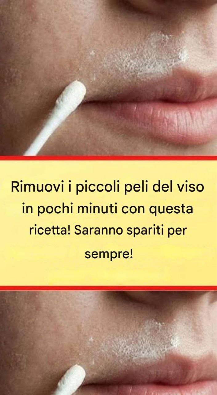 Questa ricetta naturale rimuoverà definitivamente i peli del viso