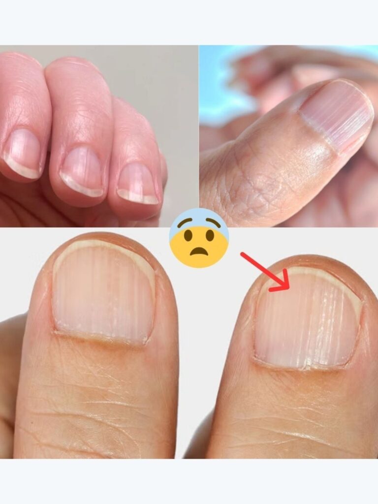 Il medico svela 7 problemi di salute nascosti nelle unghie: cosa potrebbero dirti...