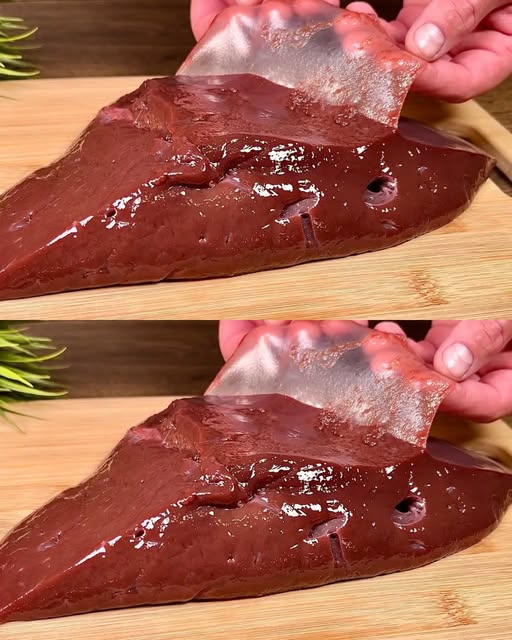 Dimenticatevi di ipoglicemia e obesità! Questa ricetta per il fegato è un vero tesoro!