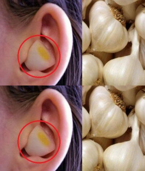 Aglio: la super medicina della natura