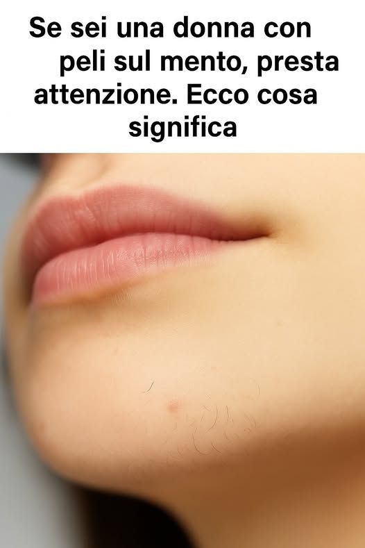 Perché le donne hanno i baffi sul mento (e cosa puoi fare per combatterli)