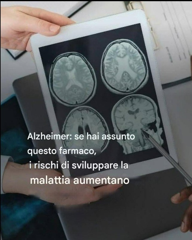 Une étude révèle un lien inquiétant entre ce médicament et la maladie d'Alzheimer...
