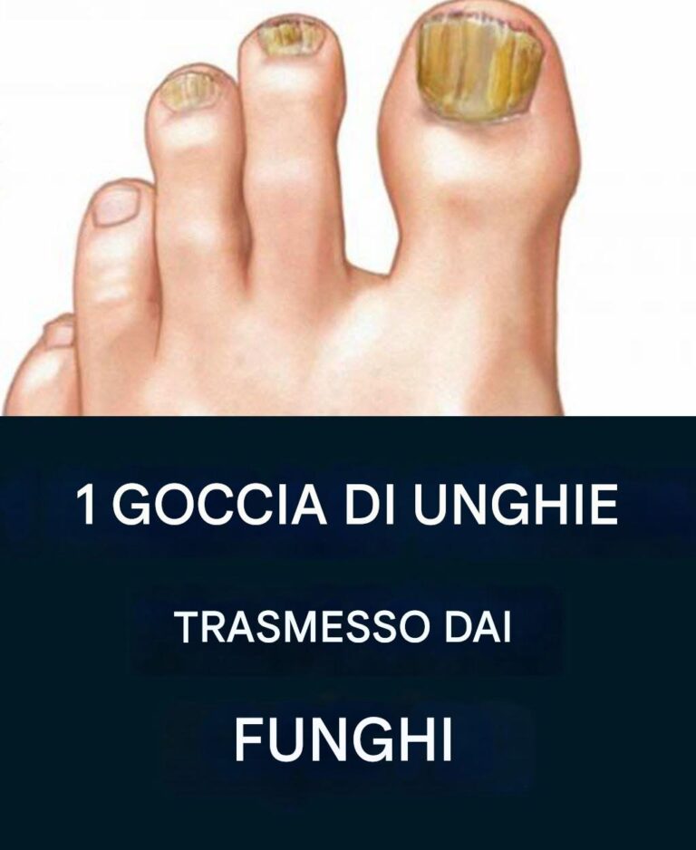 Sbarazzati del fungo dell’unghia con un metodo semplice