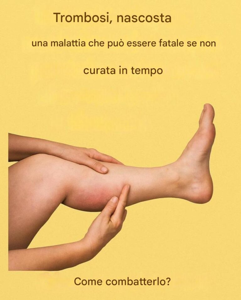 6 MIGLIORI INFUSOS PER MANTENERE LE ARTERIE SANE