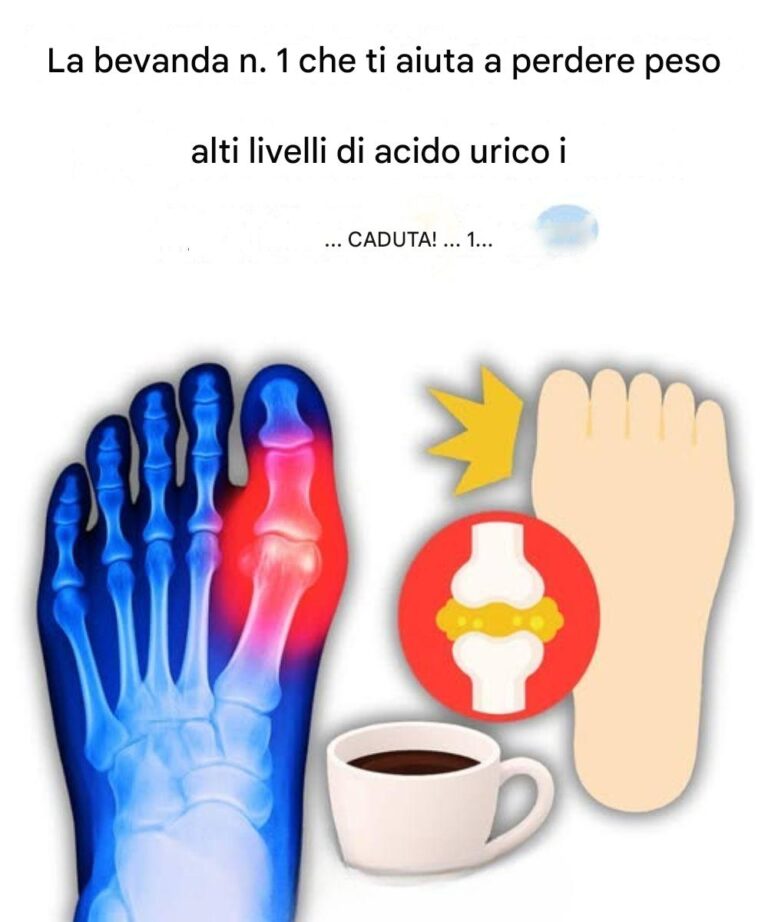 "Il mio alluce era in fiamme... Finché non ho scoperto queste 5 bevande che eliminano naturalmente l'acido urico!"