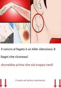 8 segnali d'allarme che indicano che il tuo fegato è pieno di tossine e ti sta rendendo obeso