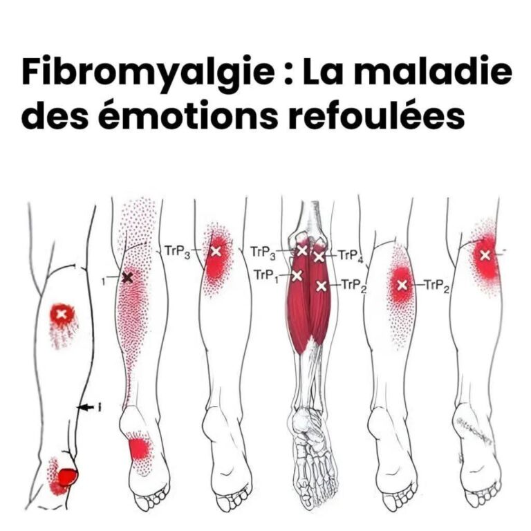 Fibromialgia: quando il corpo urla ciò che il cuore non esprime più.