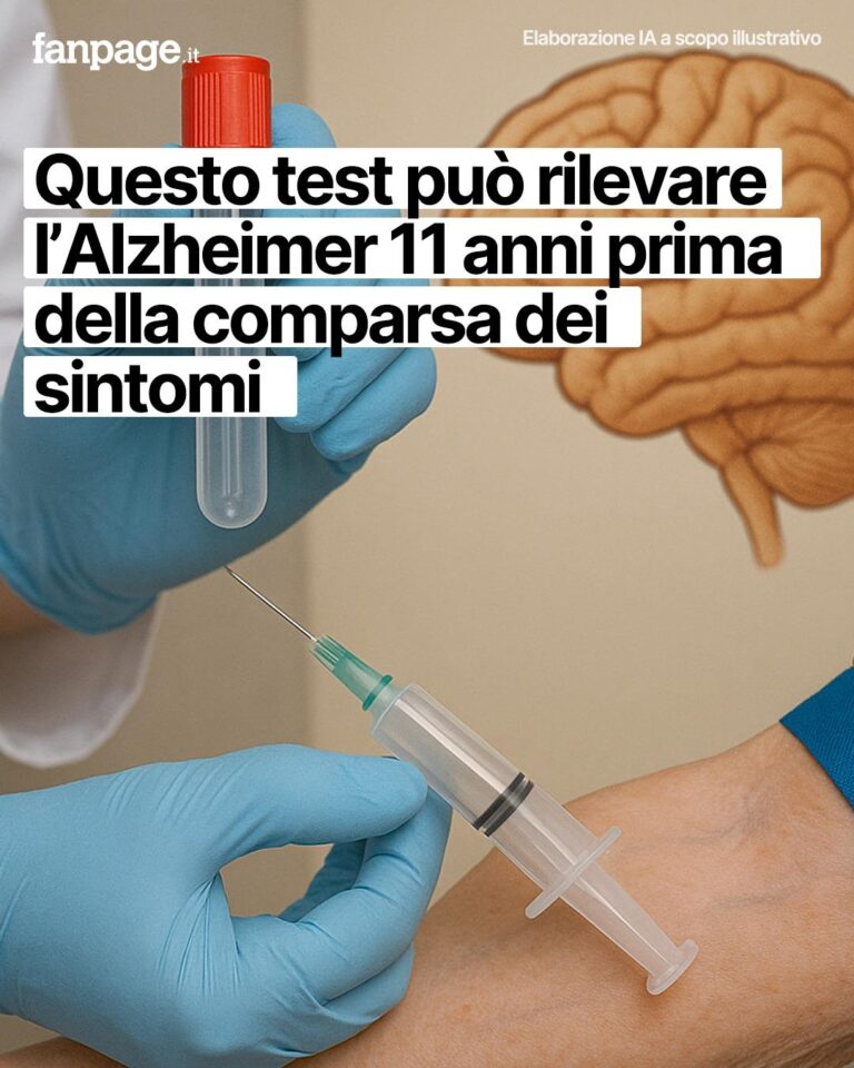Una semplice analisi del sangue potrebbe presto rivelare l’Alzheimer fino a 11 anni prima della comparsa dei sintomi. La chiave è una proteina, la beta-sinucleina, che aumenta nel sangue molto prima del declino cognitivo. Una scoperta che potrebbe rivoluzionare diagnosi e trattamenti della demenza.  Come questo test può cambiare la prevenzione dell’Alzheimer