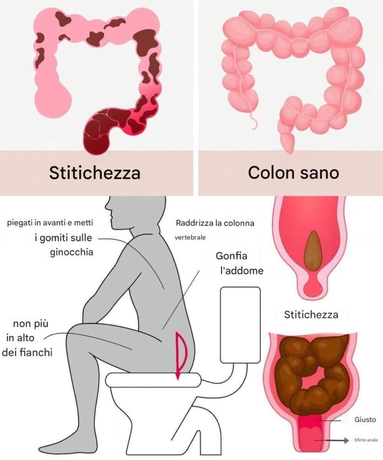 Scopri come eliminare 15 chili di scorie dal tuo colon durante la notte.
