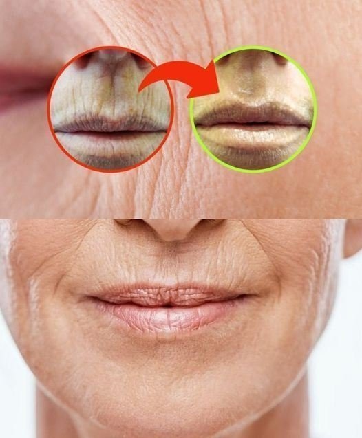RUGHE SULLA BOCCA, NON C’È BISOGNO DI PERDERE TEMPO CON LE CREME: IL RIMEDIO È IN DISPENSA
