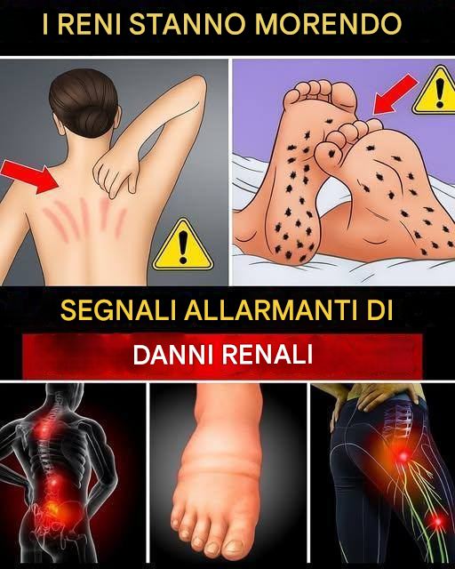 15 segnali letali di problemi renali che devi individuare in tempo