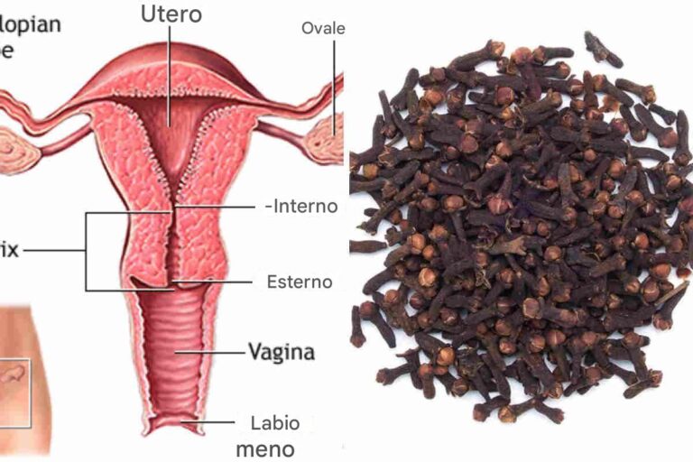 Ecco come usare i chiodi di garofano per purificare l'utero