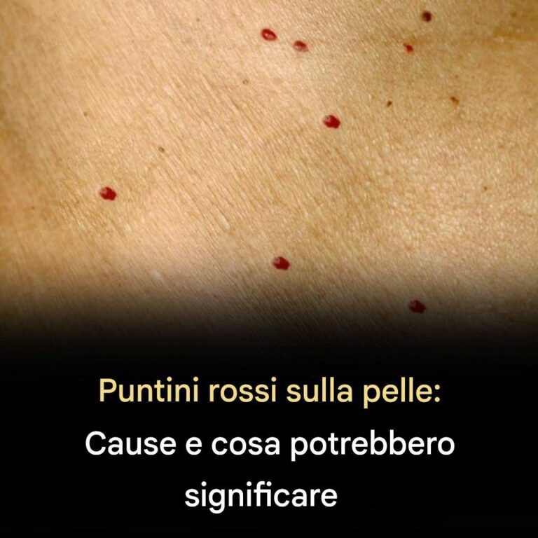 Puntini rossi sulla pelle? 11 possibili cause: quando preoccuparsi e quando no