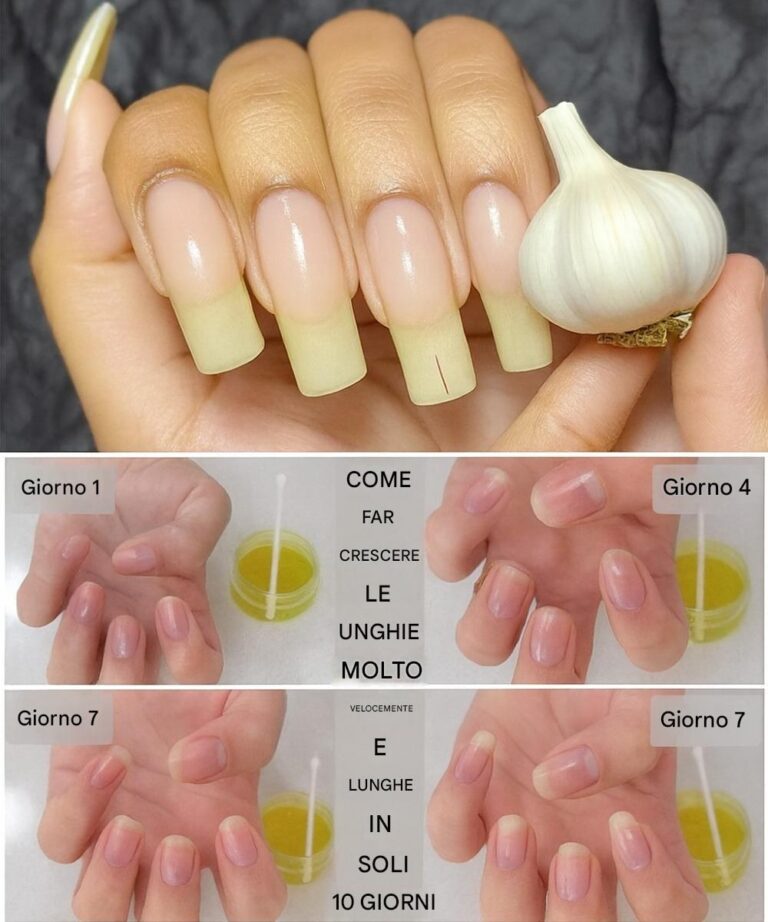 Perché le tue unghie hanno bisogno di questo rimedio rivoluzionario