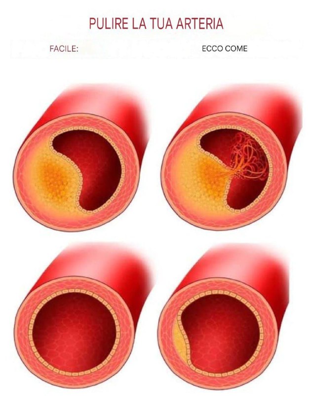 10 alimenti da mangiare ogni giorno per mantenere le arterie sane